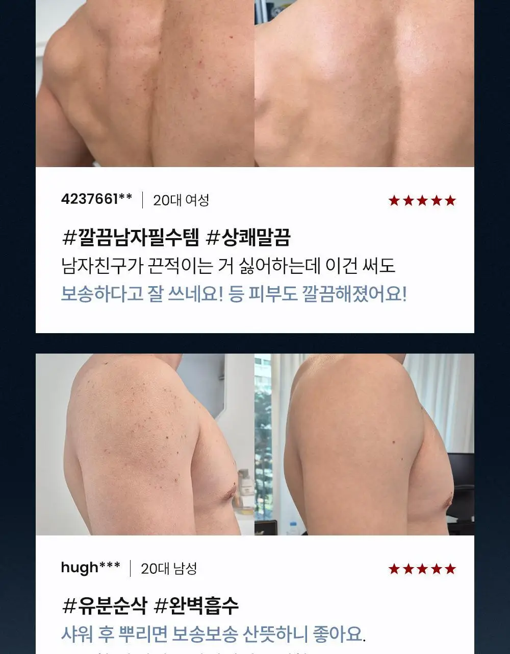 [등드름/체취케어] 낫포유 지성피부전용 등드름/가드름 클리어 바디미스트 포맨 200ml 상세페이지 15